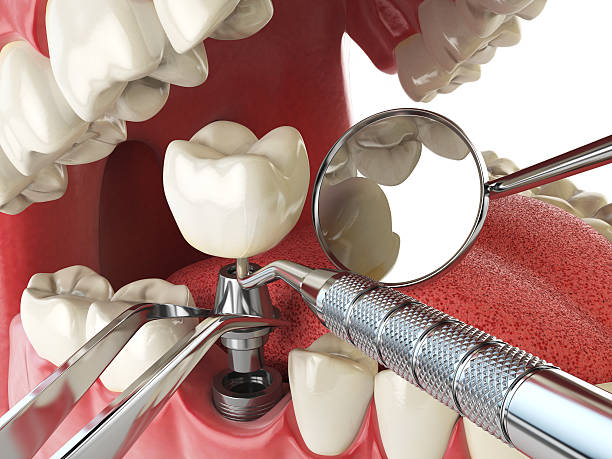 Best Emergency Treatment for Toothache in Albion, PA